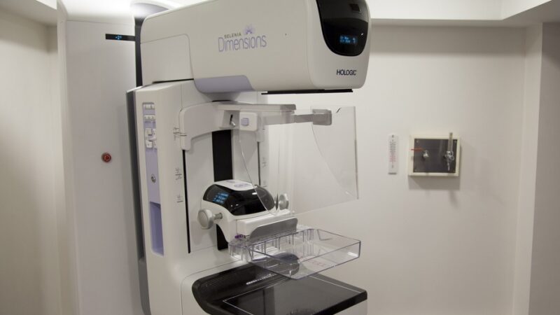 Zakup nowoczesnego mammografu przez Zagłębiowskie Centrum Onkologii w Dąbrowie Górniczej